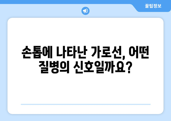 엄지손톱 가로선이 말하는 건강 신호| 당신의 몸이 보내는 메시지 | 건강, 손톱, 진단, 건강상태, 건강관리