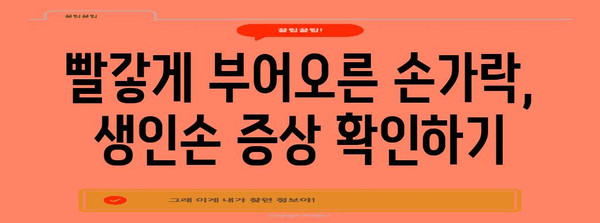 손톱과 손가락 사이 염증 완화 가이드 | 생인손 대처 방법